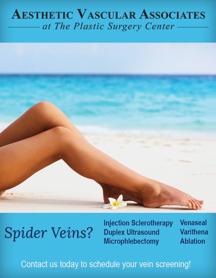 Spider Veins ad